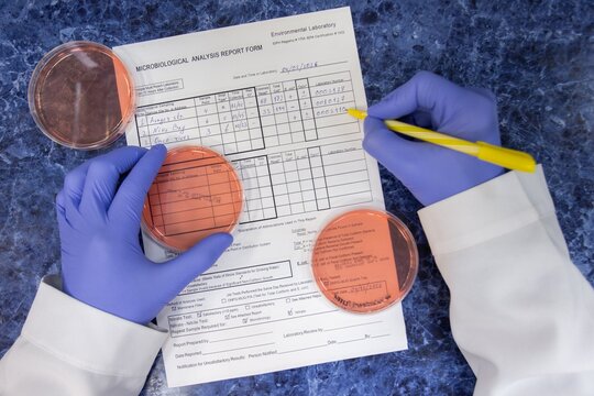 A scientist fills out a form for the analysis of bacteria on petri dishes with ENDO medium, laboratory analysis.
