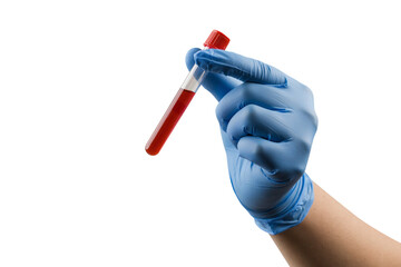test tube with donor blood in doctor's hand on blue background. gloves hold a flask of blood for a cholesterol and infection test.medical research and development.. © chathuporn