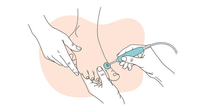 Professional podiatrist using a medical laser device to treat a patients foot for skin or nail conditions in a clinic.