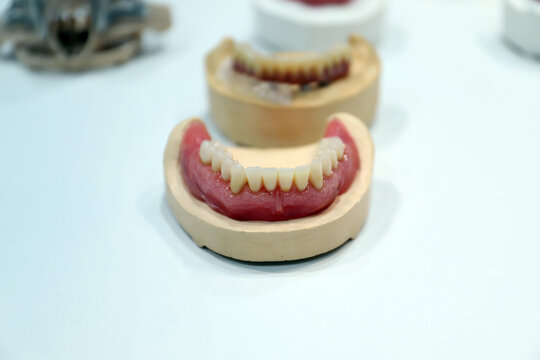 pr&oacute;tesis dental en cl&iacute;nica dental