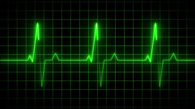Three bright green electrocardiogram spikes emerge from a dark grid background representing a healthy and consistent cardiac rhythm