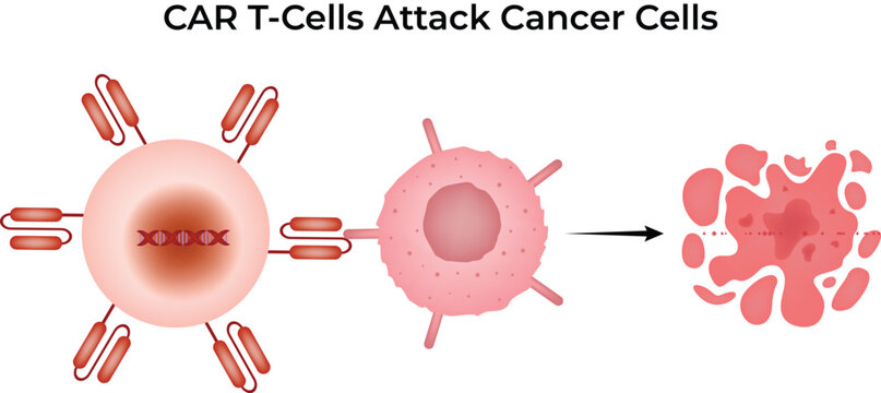 Chimeric Antigen Receptor CAR T cells Attack Cancer Cells Diagram Vector Illustration