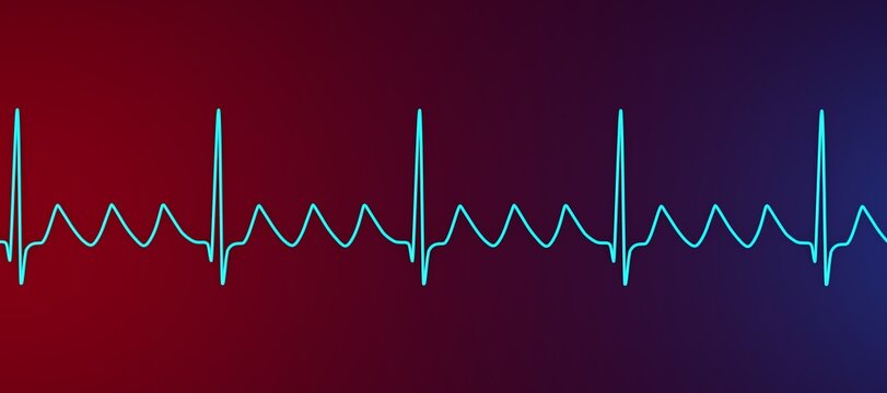 Atrial flutter ECG, 3D illustration, electrocardiogram tracing showing regular sawtooth flutter waves between QRS complexes.