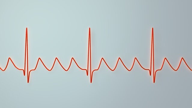Atrial flutter ECG, 3D illustration, electrocardiogram tracing showing regular sawtooth flutter waves between QRS complexes.