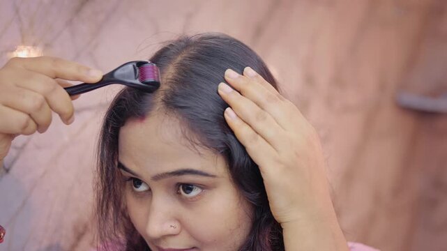 Microneedling scalp treatment, young lady using derma roller on thinning scalp area in modern bathroom.