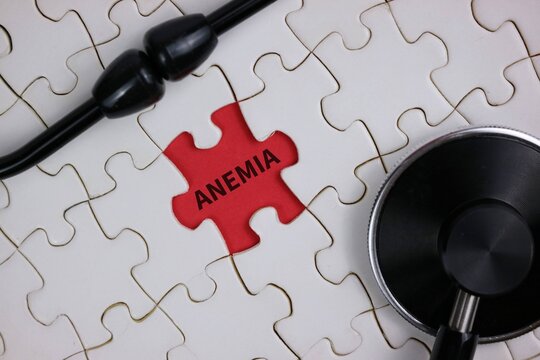 anemia highlighted on a red puzzle piece surrounded by white pieces, accompanied by a stethoscope, representing medical diagnosis, health awareness, and problem-solving in healthcare.