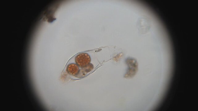 Parasite Inside a Rotifer Escapes 