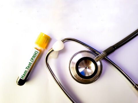 Blood sample for Nipah virus and Ham test conceotional image.