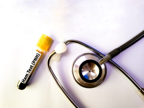 Blood sample for Nipah virus and Ham test conceotional image.
