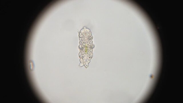 Backlit Microscopic Look at a Tardigrade (Water Bear)