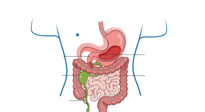 Detailed medical diagram of the human digestive system showing the stomach, intestines, and liver inside a body outline.