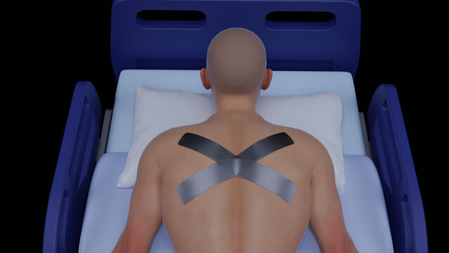 Rehabilitation and physiotherapy treatment with a man using kinesiology tape for back pain relief, wellness, reflexology, and biokinetics.
