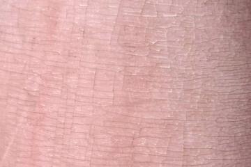 Fototapeta premium Cracked pink paint texture background with a rustic, weathered appearance