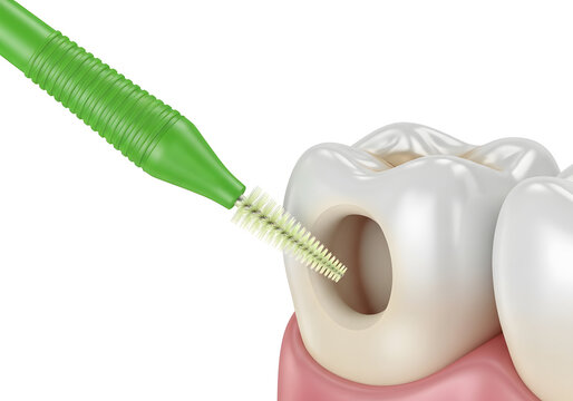 Green interdental brush cleaning between white teeth with pink gums