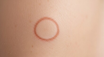 Fototapeta premium A close-up view of a circular red mark on human skin