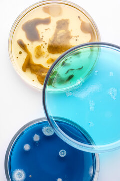 Biochemistry. Petri dishes with samples on white background, top view
