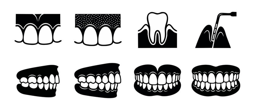 Dental Teeth Icons Set for Dentistry and Oral Health Care, Periodontal Disease Treatment and Orthodontics Symbols, Flat Black Graphic Elements for Medical Clinic Website and Tooth Anatomy Infographics