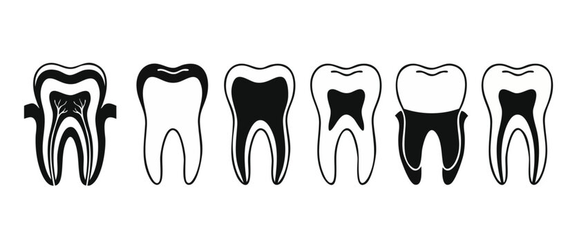 Tooth Decay Stages Icon Set Dental Health Vector Illustration Showing Cavity Progression and Root Canal Treatment for Oral Hygiene Education and Dentist Office Clinic Poster Design Infographic Element