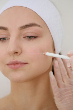 Cosmetic markings on female face before beauty procedure