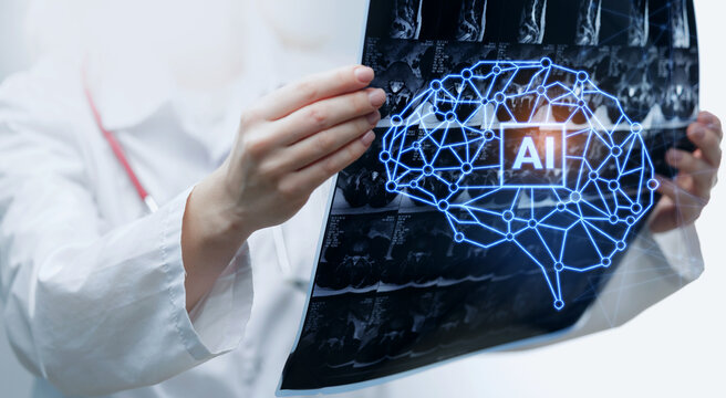 Doctor holding radiology xray film with ai brain overlay for medical imaging analysis and diagnostic data center, concept healthcare technology