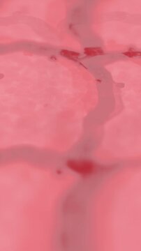 Skin Cells up Close on Human Dermis - Rosacea of Enflamed Psoriasis - Vertical
