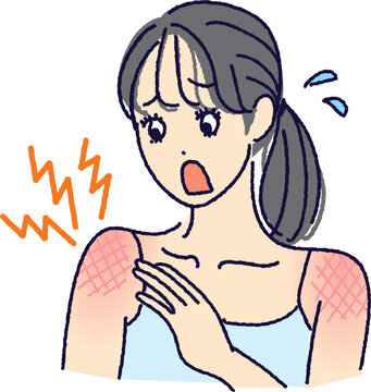 日焼けで肌がヒリヒリ傷んでいる女性のイラスト（紫外線ダメージ・肌トラブル）
