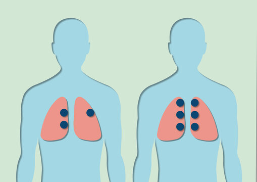 Stethoscope placement, illustration