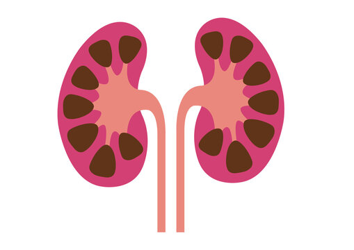Kidneys and ureters, illustration