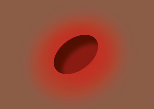 Ulcer, conceptual illustration