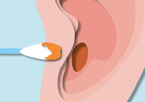 Ear wax, conceptual illustration