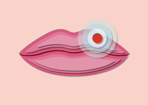 Cold sore, conceptual illustration