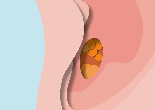 Ear wax, conceptual illustration