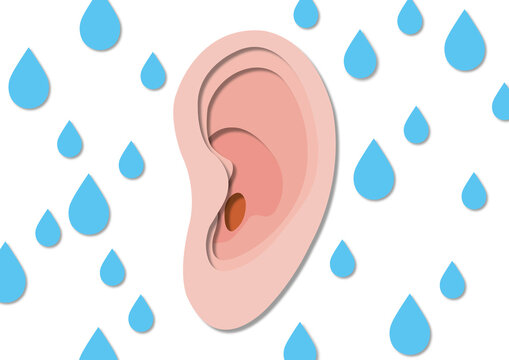 Swimmer's ear, conceptual illustration