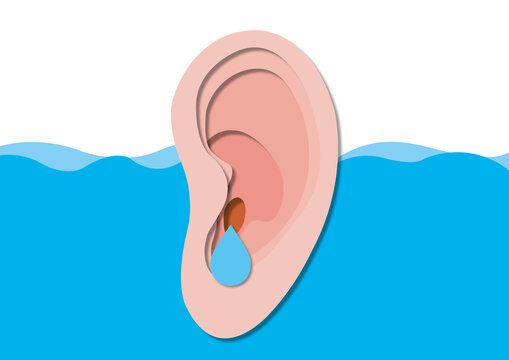 Swimmer's ear, conceptual illustration