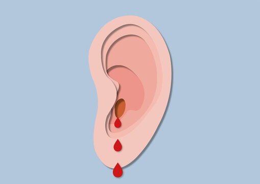 Bleeding ear, conceptual illustration