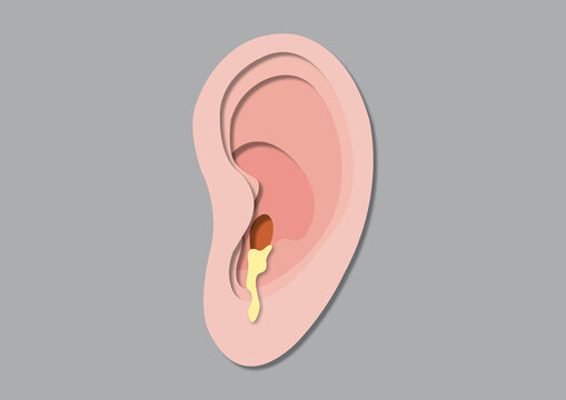Ear discharge, conceptual illustration