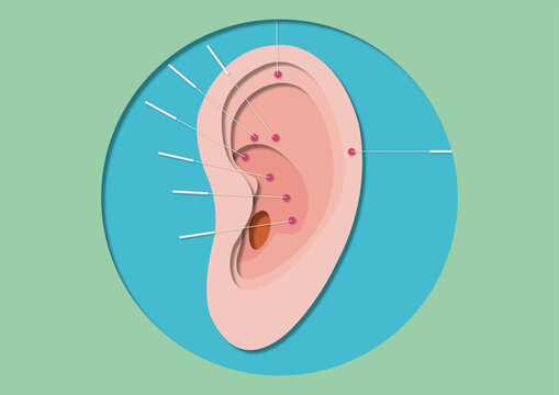 Ear acupuncture, conceptual illustration