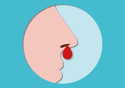Nose bleed, conceptual illustration