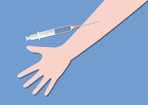 Arterial blood gas test, conceptual illustration