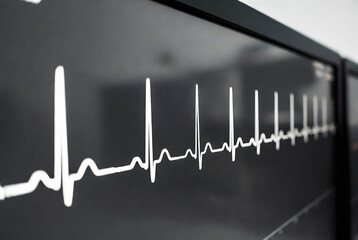 Obraz premium A heartbeat monitor graphic is displayed on a dark, reflective surface. It suggests a medical or healthcare environment.