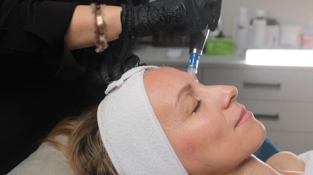 Cosmetologist performing a professional microneedling treatment on a mature woman's forehead