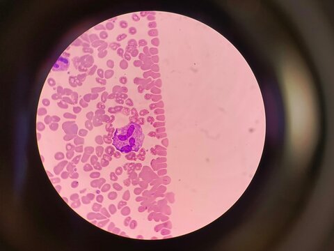 High magnification microscopic view of a segmented neutrophil in a human blood smear 