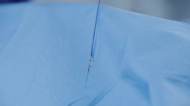 Trap for Atherosclerotic plaque catheter insertion during cardiac catheterization procedure on sterile drape for medical cardiology background.