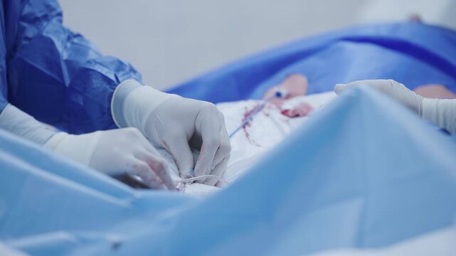 Tracking shot of surgeon hands performing abdominal surgery in sterile operating room with slow lateral handheld movement.