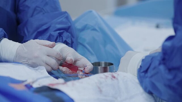 Surgeons hands suturing during cardiac operation for medical poster and healthcare.