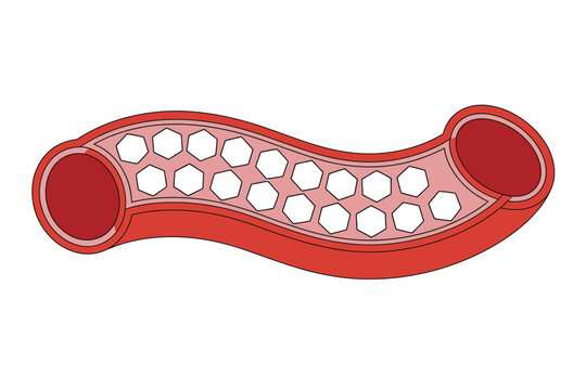 Diabetes disease glucose in blood vessels medical illustration for high blood sugar condition insulin imbalance and health concept