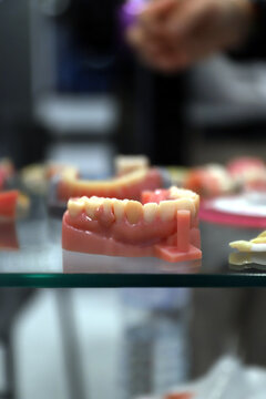 molde de dentadura de dientes en cl&iacute;nica dental