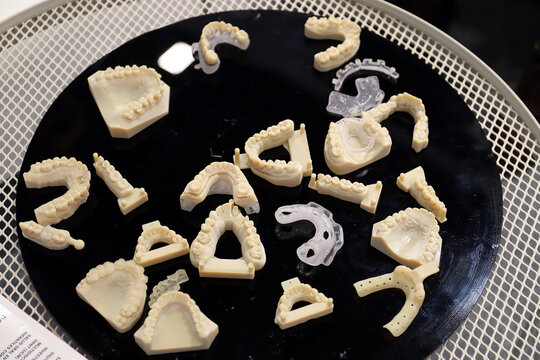 dentaduras y ortodoncias de dientess con moldes dentales