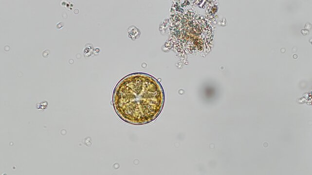 Coscinodiscus sp. diatom under brightfield microscope at 50x