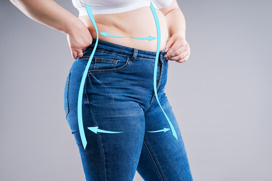 Overweight woman in tight jeans, concept of diet, weight loss, body slimming and liposuction